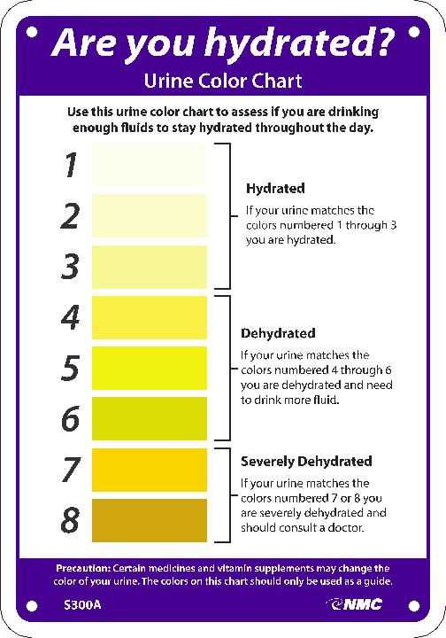 ARE YOU HYDRATED URINE COLOR CHART SIGN, 10X7, .040 ALUM
